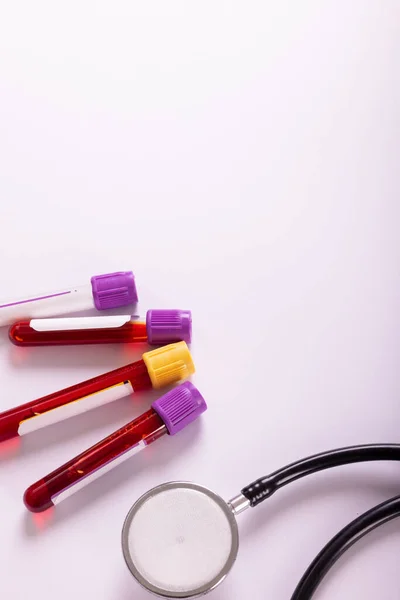 Overhead View Test Tubes Blood Samples Stethoscope White Background Copy — Fotografia de Stock