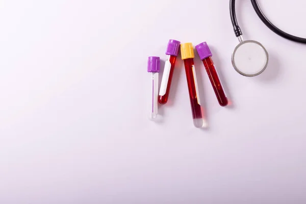 Directly Shot Blood Samples Test Tubes Stethoscope White Background Copy — Photo