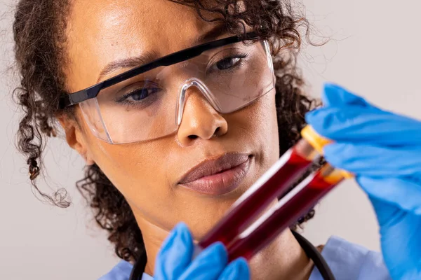 Närbild Afrikansk Amerikansk Mellanvuxen Kvinnlig Läkare Bär Skyddande Glasögon Hålla — Stockfoto