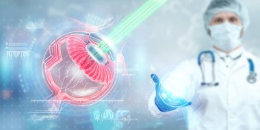 Lazer göz ameliyatı, insan gözü hologramı ve lazer ışını. Doktor ameliyatı gerçekleştirir. Göz cerrahisi, katerakt, ostegmatizm, modern göz doktoru.