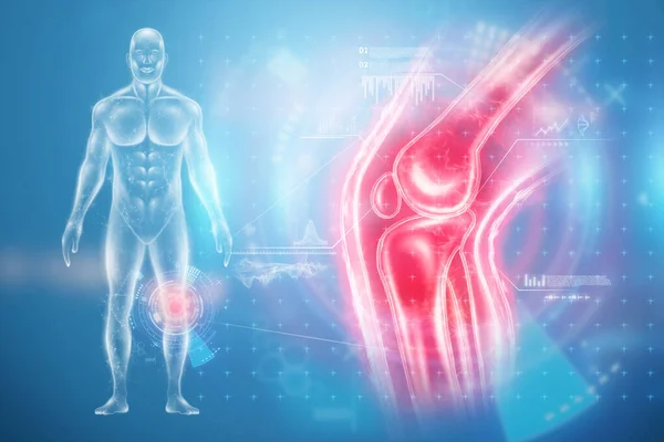 Ray Van Een Pijnlijke Knie Hologram Van Gewrichten Structuur Van — Stockfoto