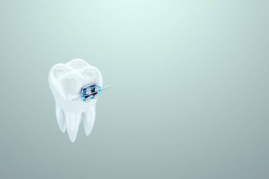 Mavi arka planda metal diş telleri olan beyaz dişler. Diş telleri, diş hekimliği, diş beyazlatma, koruma, ağız bakımı, hijyen, sağlık hizmetleri. 3B illüstrasyon, 3B canlandırma