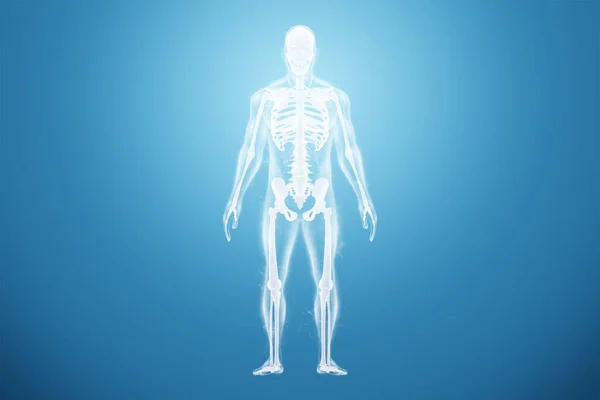 Medische Poster Menselijk Lichaam Silhouet Met Een Skelet Erin Gewrichtspijn — Stockfoto