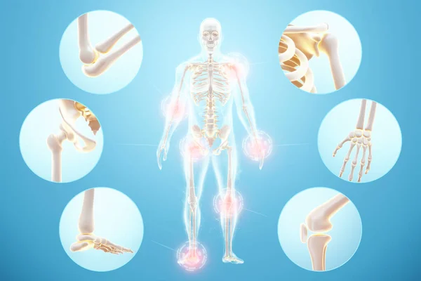 Medizinisches Plakat Menschliche Körpersilhouette Mit Einem Skelett Inneren Gelenkschmerzen Wirbelsäule — Stockfoto