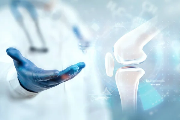 Affiche Médicale Image Des Genou Articulation Dans Genou Arthrite Inflammation — Photo