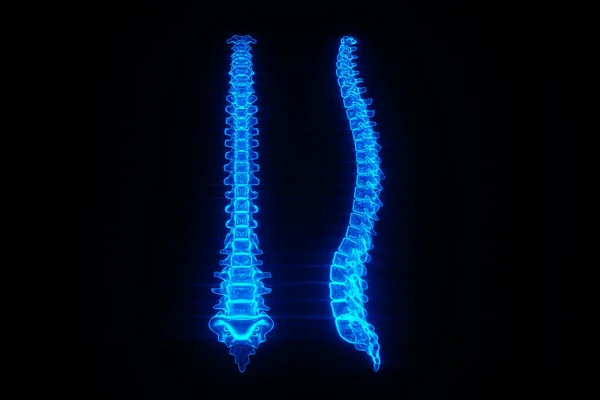 Cartel Médico Anatomía Columna Vertebral Humana Imagen Del Holograma Los Imágenes De Stock Sin Royalties Gratis