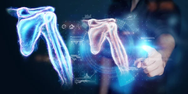 Medizinisches Poster Anatomie Des Menschlichen Körpers Röntgenbild Des Schultergelenks Hologramm — Stockfoto