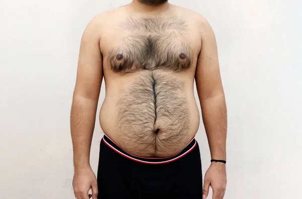 A portrait of a asian fat man show out his body and big belly. Concept of Obesity