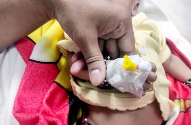 A Children patient's hand recieving iv saline solution in hostpital