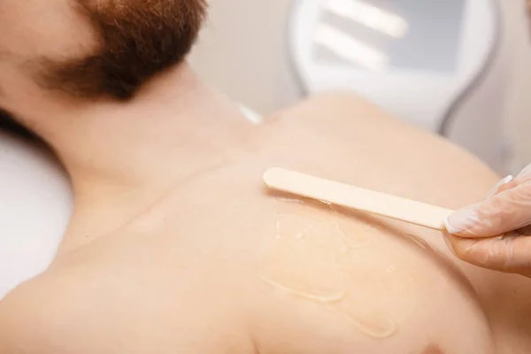 Conceito de depilação a laser para homens. Salão de beleza trabalhador aplica gel ao corpo cara antes da remoção do cabelo — Fotografia de Stock