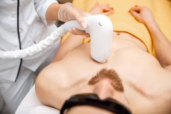 Концепция процедуры лазерной эпиляции волос грудь для человека в салоне красоты — стоковое фото