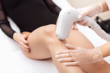 Bacakları lazer temizleme tedavisi, vücut bakımı yapan kadın. Sağlık ve güzellik kavramı