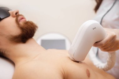 Erkekler için lazer epilasyon konsepti. Güzellik salonu çalışanı, tedavi gören adama vücut kılı aldırıyor.