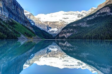Louise Gölü, Banff Ulusal Parkı