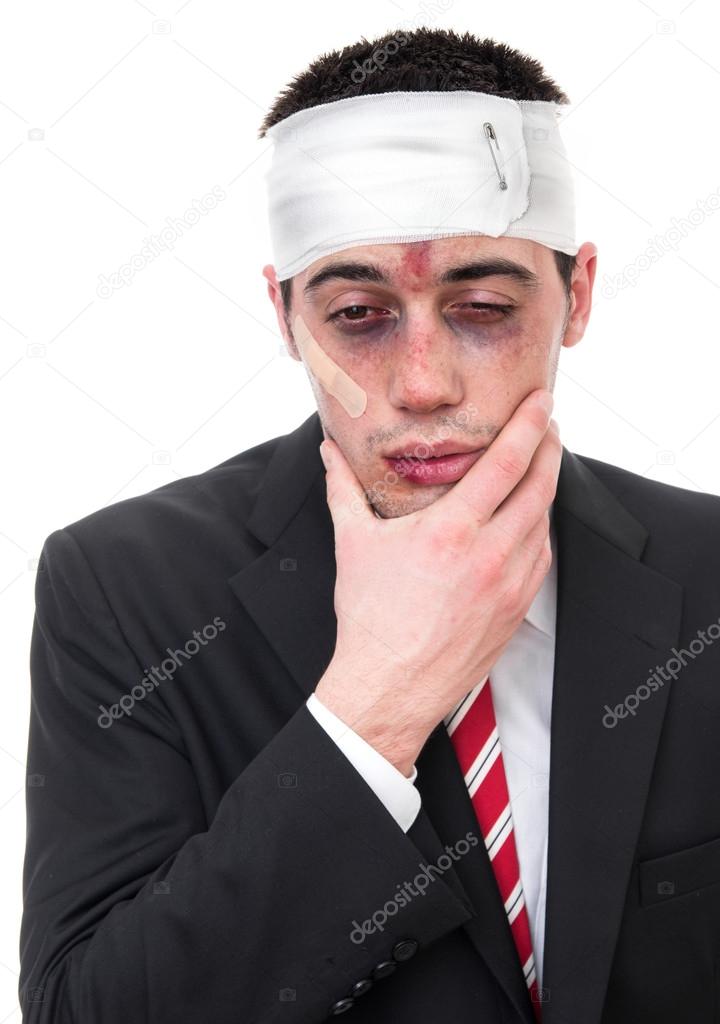 Man with bruised eyes and head