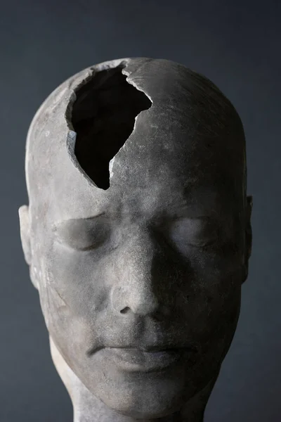 Mental Health Concept Showing Model Of Head With Fractured Piece In Skull