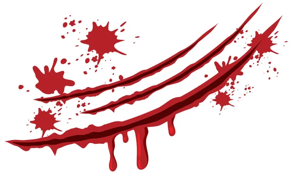 Heridas Rasguño Sangre Sobre Fondo Blanco Ilustración — Vector de stock