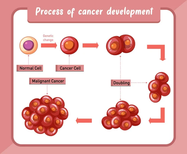 がん発生の過程 インフォグラフィックイラスト — ストックベクタ