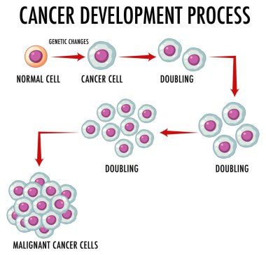 Kanser Devlopment Süreci Infographic Illustration