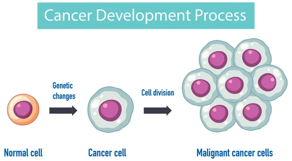 Cancer Devlopment Processo Ilustração Infográfica — Vetor de Stock