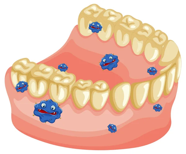 Modelo Dientes Humanos Amarillos Con Ilustración Bacterias — Archivo Imágenes Vectoriales