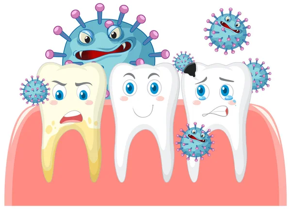 Condición Dental Los Dientes Diferentes Con Bacterias Ilustración Fondo Blanco — Archivo Imágenes Vectoriales