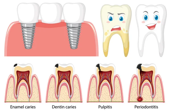 Set Aller Arten Von Zähnen Auf Weißem Hintergrund — Stockvektor