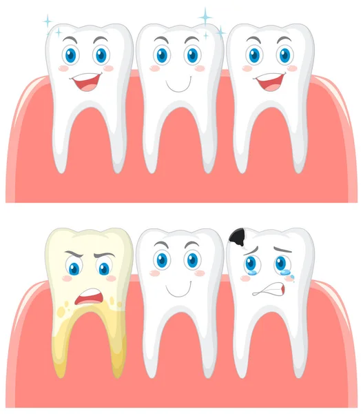 Conjunto Dientes Fuertes Caries Dental Sobre Fondo Blanco Ilustración — Vector de stock