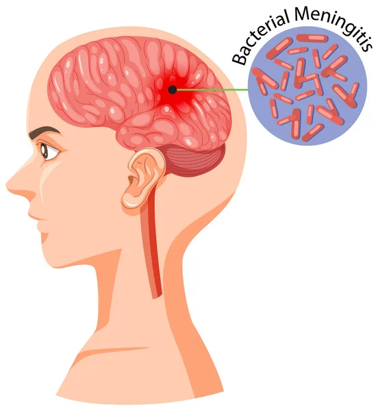 脳図付き人間の頭部 — ストックベクタ