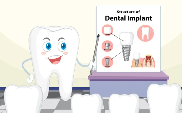 Infografika Człowieka Strukturze Implantu Dentystycznego Ilustracja — Wektor stockowy