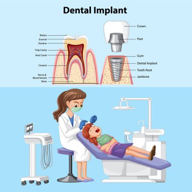 Poster dental implant with dentist woman examining patient teeth  illustration clipart
