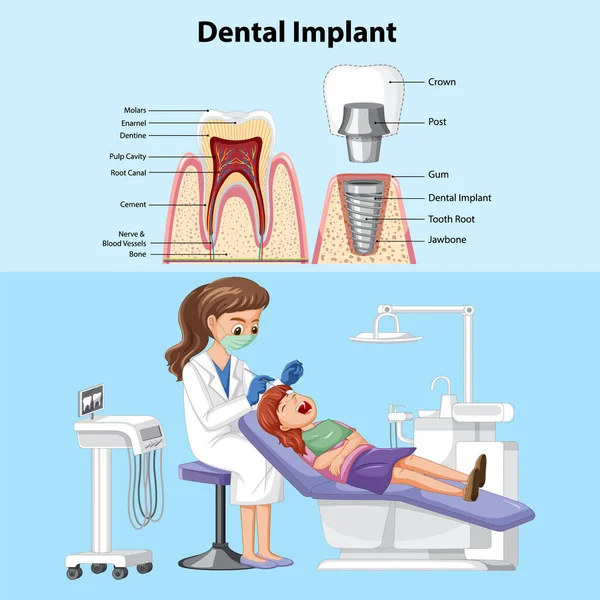 Poster Dental Implant Dentist Woman Examining Patient Teeth Illustration — Stock Vector