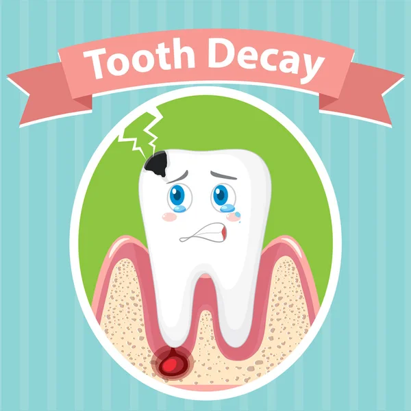 Dental Healthy Big Tooth Decay Poster Illustration — Stock Vector