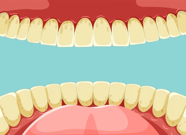 Dientes Humanos Dentro Boca Con Dientes Amarillos Ilustración — Vector de stock