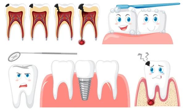 Set Tutti Tipi Denti Sfondo Bianco Illustrazione — Vettoriale Stock