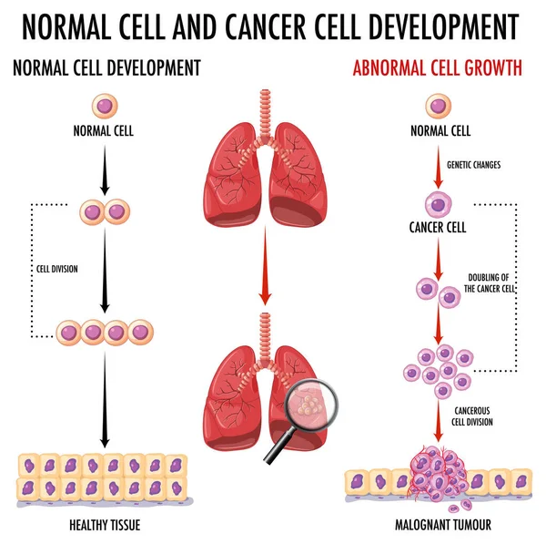 示出人类正常细胞和癌细胞的示意图 — 图库矢量图片