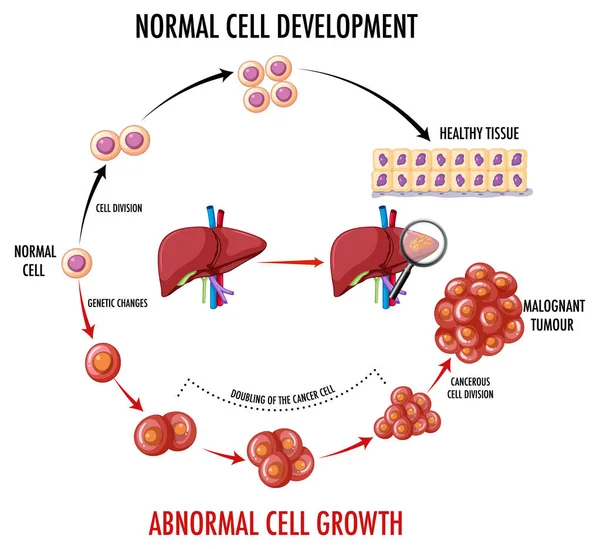 Diagrama Mostrando Células Normais Cancerosas Ilustração Humana —  Vetores de Stock