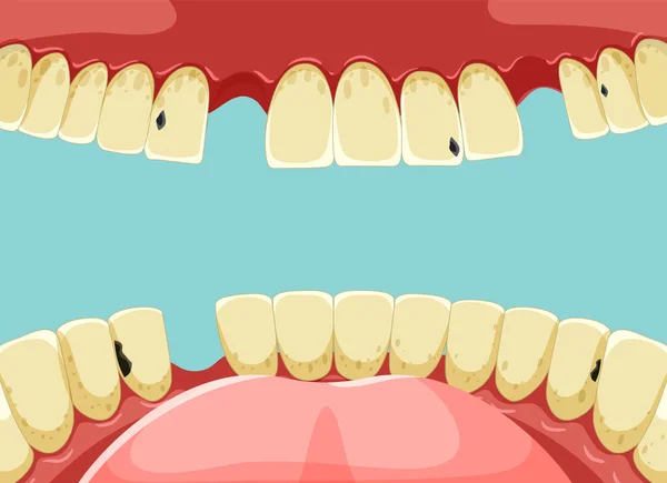 Dientes Humanos Dentro Boca Con Ilustración Dientes Rotos Amarillos — Vector de stock