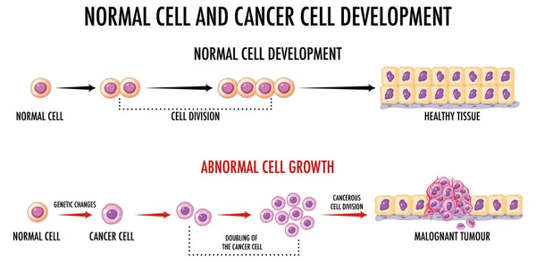 显示正常细胞和癌细胞的示意图 — 图库矢量图片
