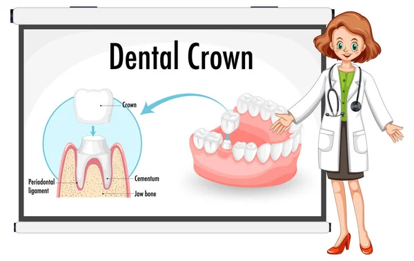 Инфографика Человека Зубной Короне — стоковый вектор