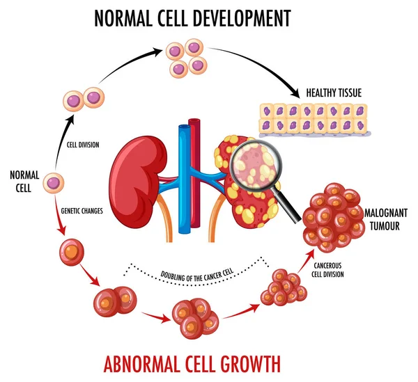 Schemat Przedstawiający Normalne Komórek Nowotworowych Ilustracji — Wektor stockowy
