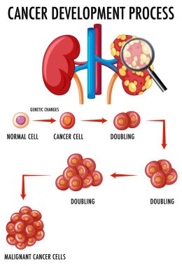 Kanser geliştirme sürecinin resimlerini gösteren diyagram