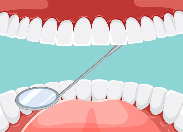 Instruments Examining Patient Teeth Human Mouth Illustration — Stock Vector