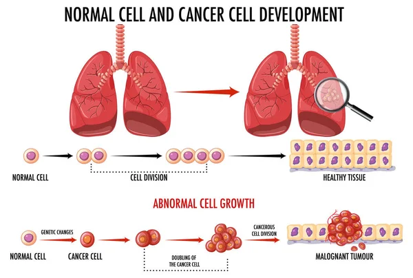 Диаграмма Показывающая Нормальную Раковую Клетку — стоковый вектор