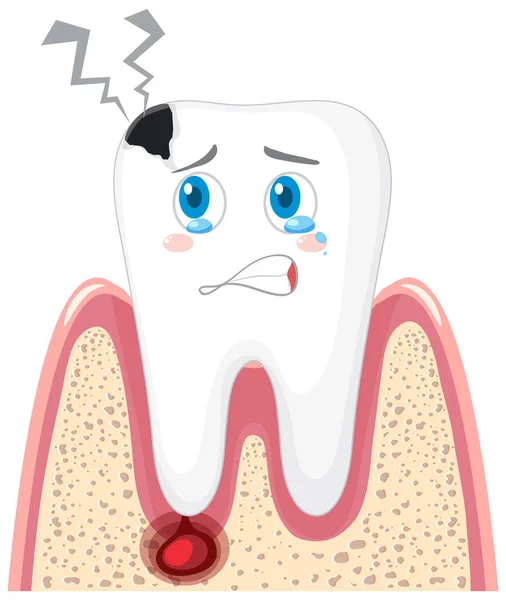 Caries Inflammation Gums White Background Illustration — Archivo Imágenes Vectoriales