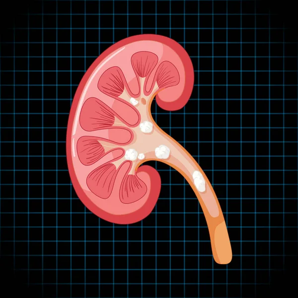 Órgano Interno Humano Con Ilustración Renal — Vector de stock