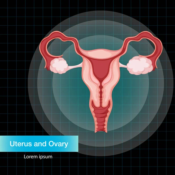 Human Internal Organ Uterus Illustration — Stockvector