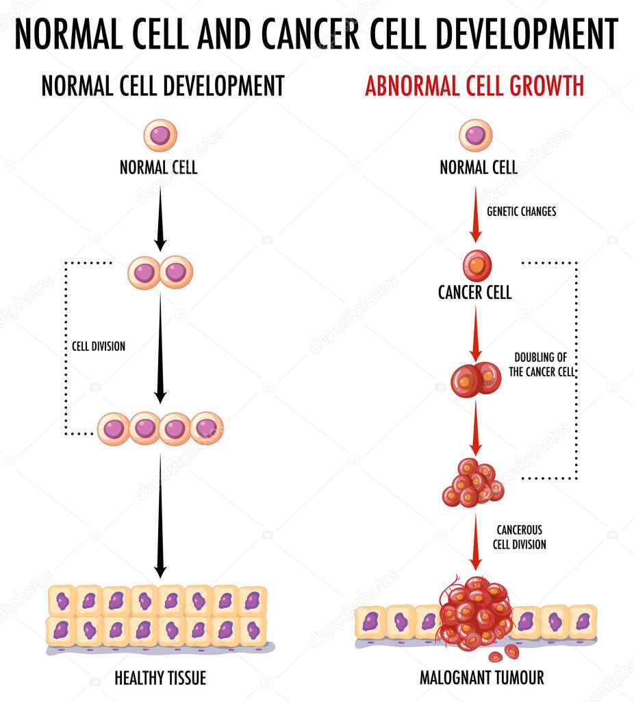 Diagram showing normal and cancer cell development illustration
