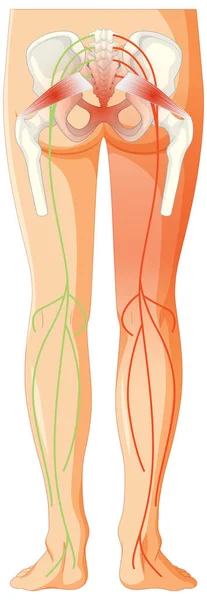 Espalda Inferior Que Sufre Espondilitis Anquilosante Ilustración — Archivo Imágenes Vectoriales