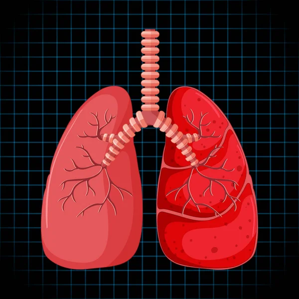 Órgano Interno Humano Con Ilustración Pulmonar — Archivo Imágenes Vectoriales